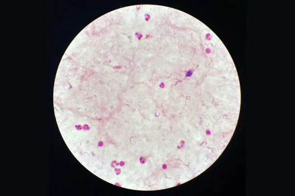Parasita Trypanosoma brucei causa doença do sono via mosca tsé-tsé. (Foto: Getty Images via Canva)