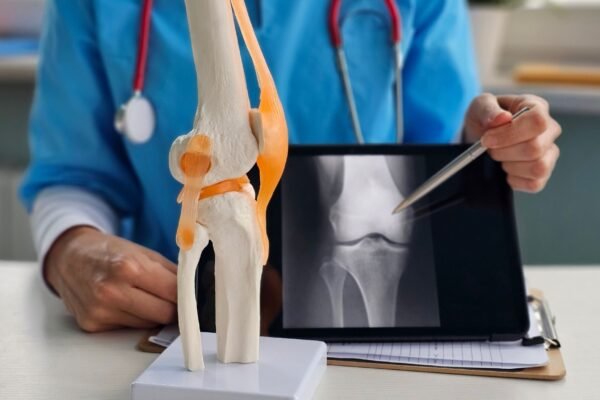 Dieta influencia dor e desgaste nos joelhos. (Foto: Pixabay via Canva)