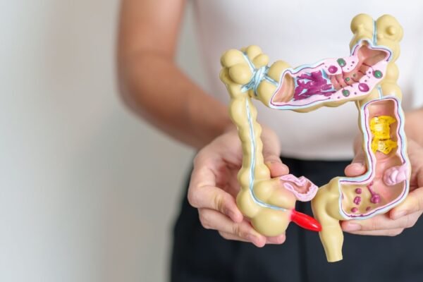 Fase de reintrodução é parte importante da dieta FODMAP. (Foto: Getty Images via Canva)