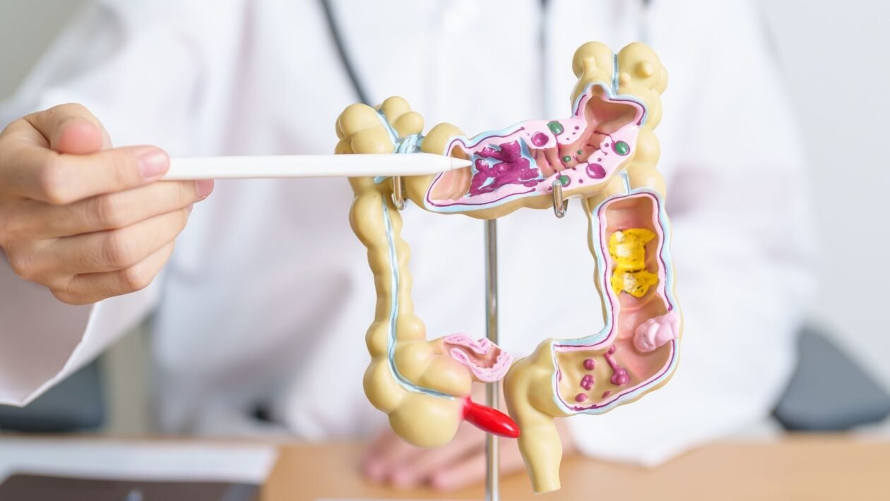 Microbioma pode afetar tratamento do câncer. (Foto: Getty Images via Canva)