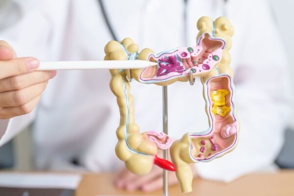 Microbioma pode afetar tratamento do câncer. (Foto: Getty Images via Canva)