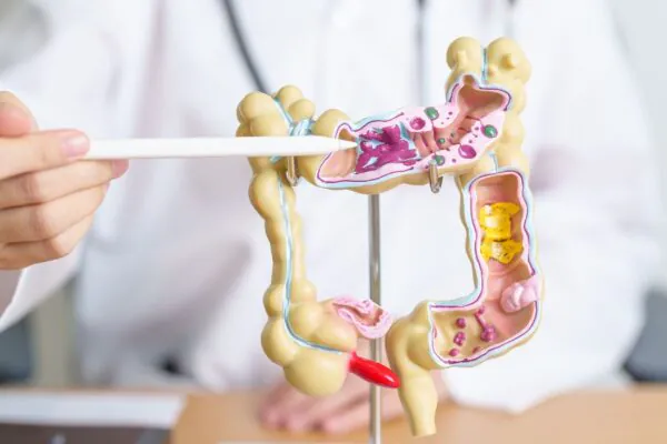Microbioma pode afetar tratamento do câncer. (Foto: Getty Images via Canva)