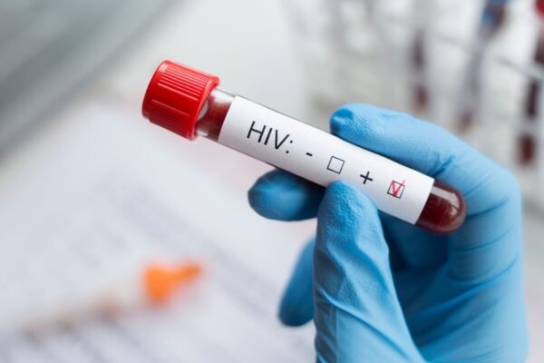 HIV revela pontos fracos com nova tecnologia científica. (Foto: Getty Images via Canva)