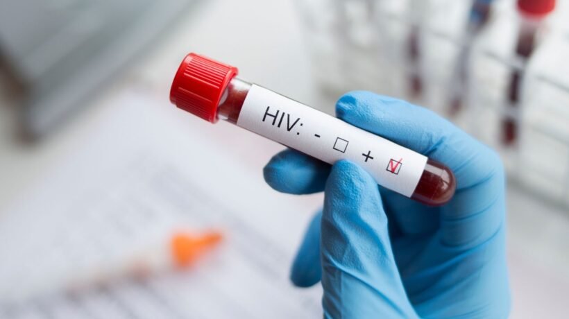 HIV revela pontos fracos com nova tecnologia científica. (Foto: Getty Images via Canva)