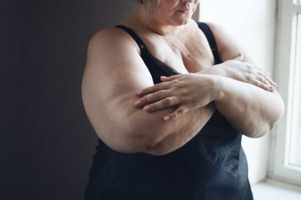 Baixa massa muscular e gordura impactam longevidade. (Foto: Halfpoint via Canva)