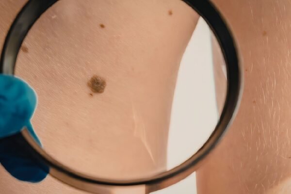 Proteína HOXD13 ajuda tumor a crescer e se esconder. (Foto: Felicia Manolache via Canva)