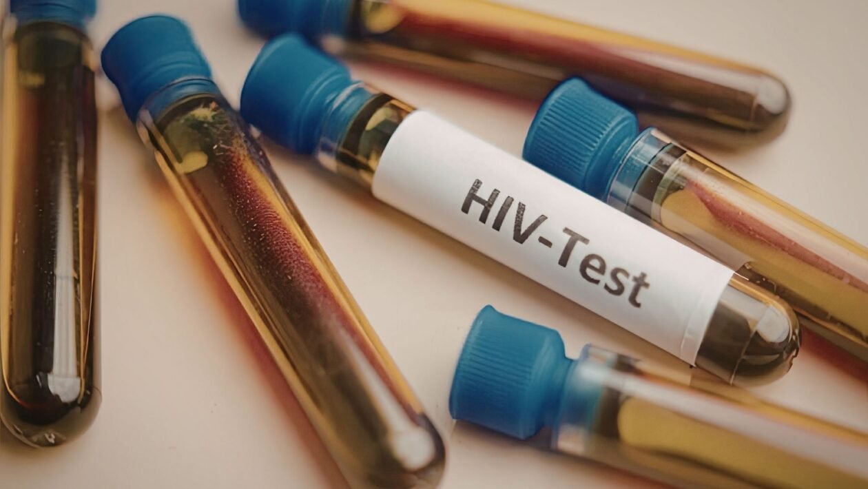 Transplante com irmão leva à remissão do HIV. (Foto: Sofia Gabureanu via Canva)