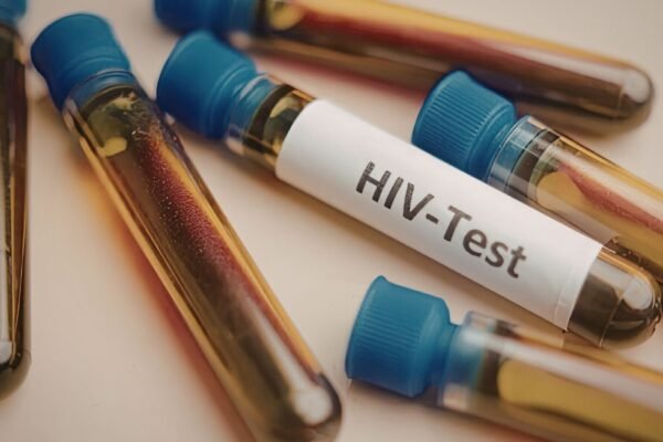 Transplante com irmão leva à remissão do HIV. (Foto: Sofia Gabureanu via Canva)