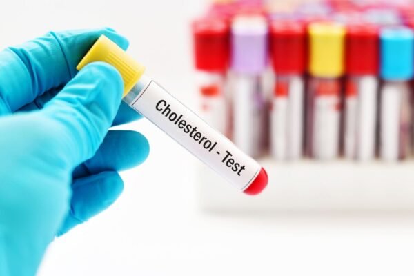 Colesterol na infância pode prevenir doenças futuras. (Foto: Getty Images via Canva)