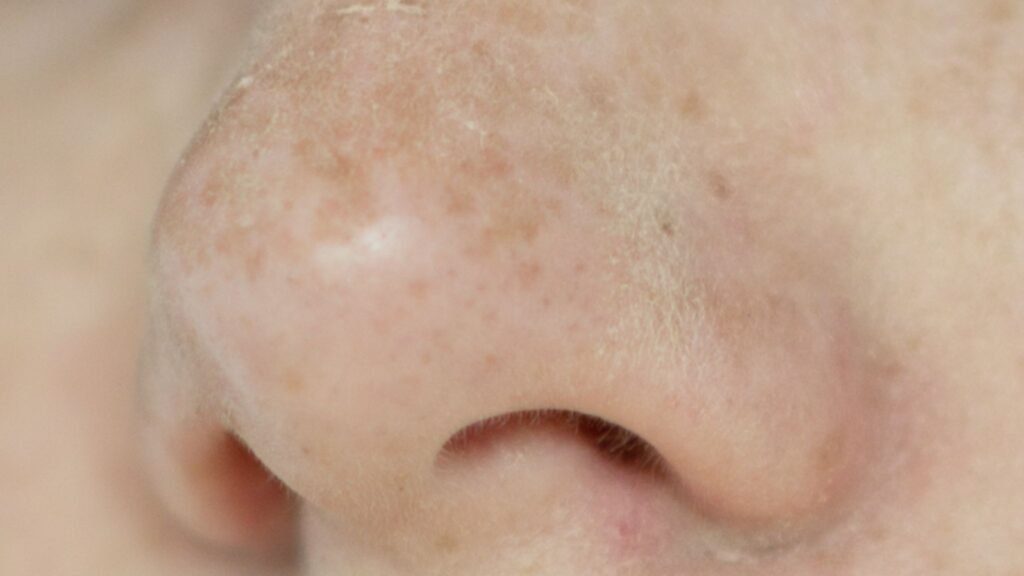 Alterações no olfato podem ser alerta. (Foto: Getty Images via Canva)