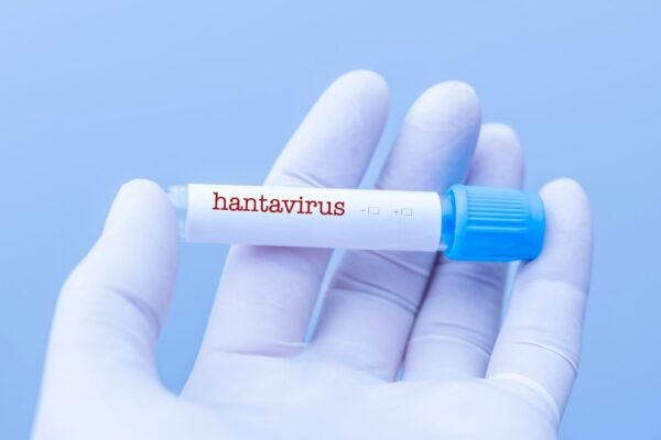 Hantavírus exige atenção em áreas rurais. (Foto: Getty Images via Canva)