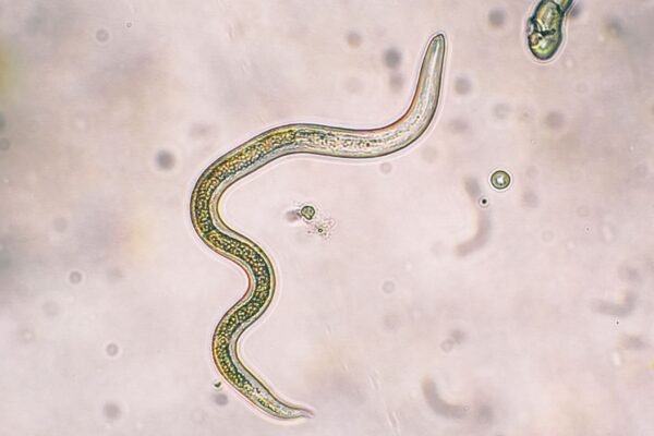 Larvas de Toxocara canis vistas em microscopia, associadas à toxocaríase. (Foto: Getty Images via Canva)