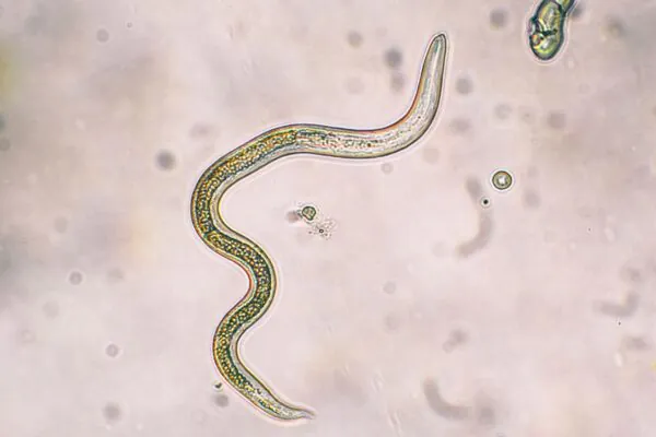 Larvas de Toxocara canis vistas em microscopia, associadas à toxocaríase. (Foto: Getty Images via Canva)