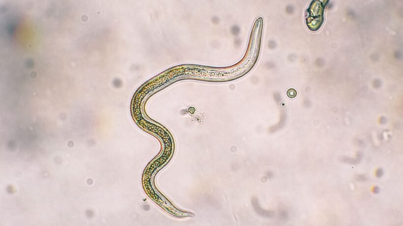 Larvas de Toxocara canis vistas em microscopia, associadas à toxocaríase. (Foto: Getty Images via Canva)