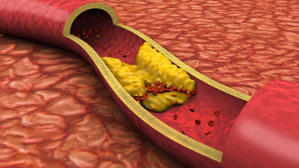 Mudanças hormonais elevam colesterol após menopausa. (Foto: Getty Images via Canva)