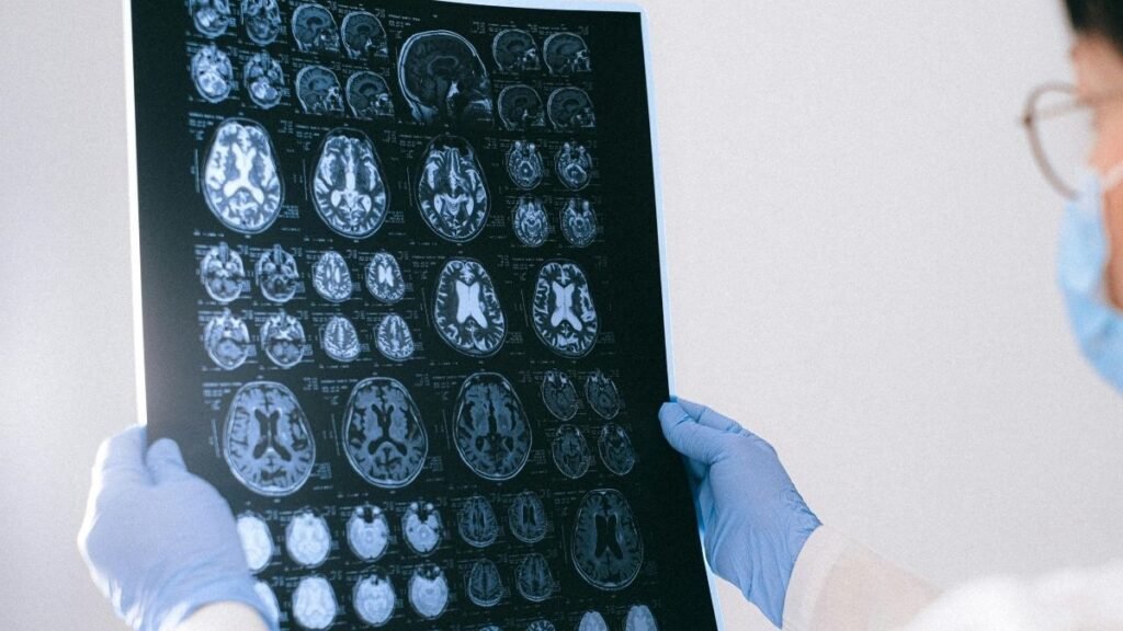 Alergia pode estar ligada à memória e cognição. (Foto: Pexels via Canva)