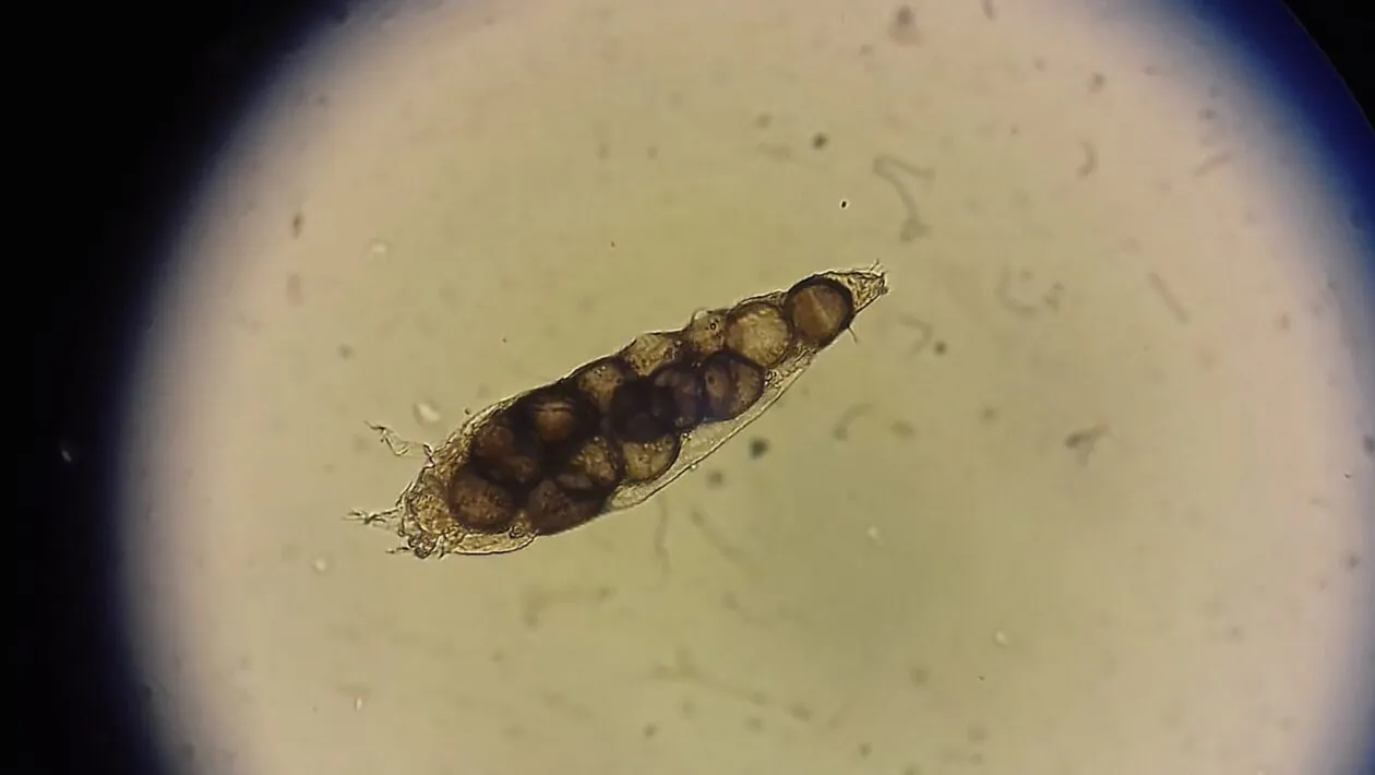 Os Demodex saem dos poros durante a noite. (Foto: Getty Images via Canva)