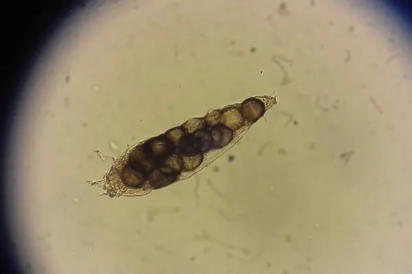 Os Demodex saem dos poros durante a noite. (Foto: Getty Images via Canva)