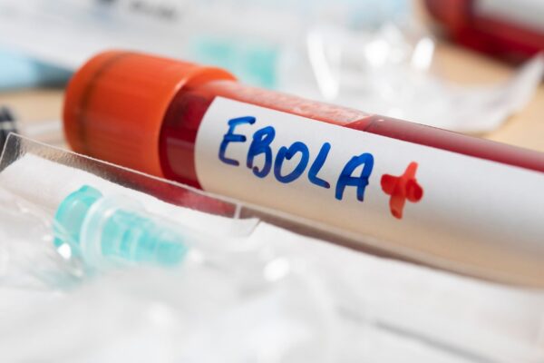 Suspeita de Ebola mobilizou protocolo especial. (Foto: Getty Images via Canva)