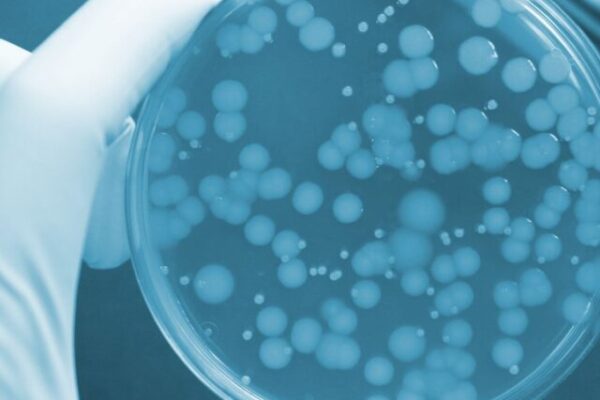 bacteria ypê e crystal 1234