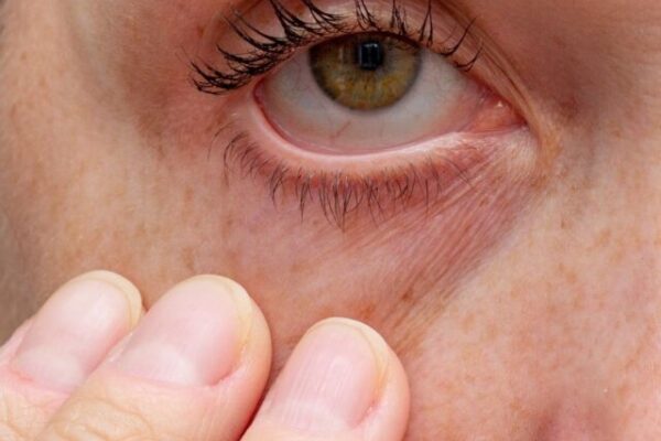 olhos secos IA