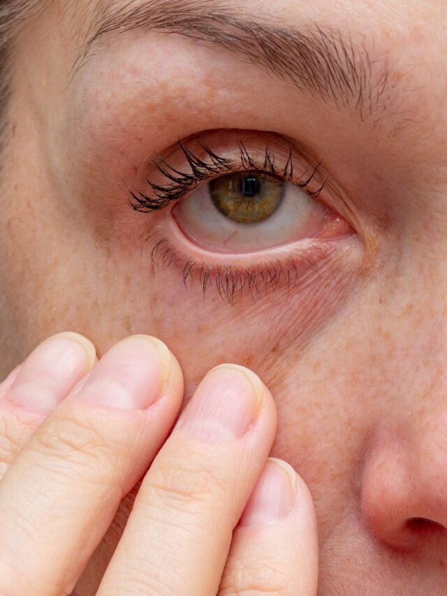A IA está ressecando seus olhos?