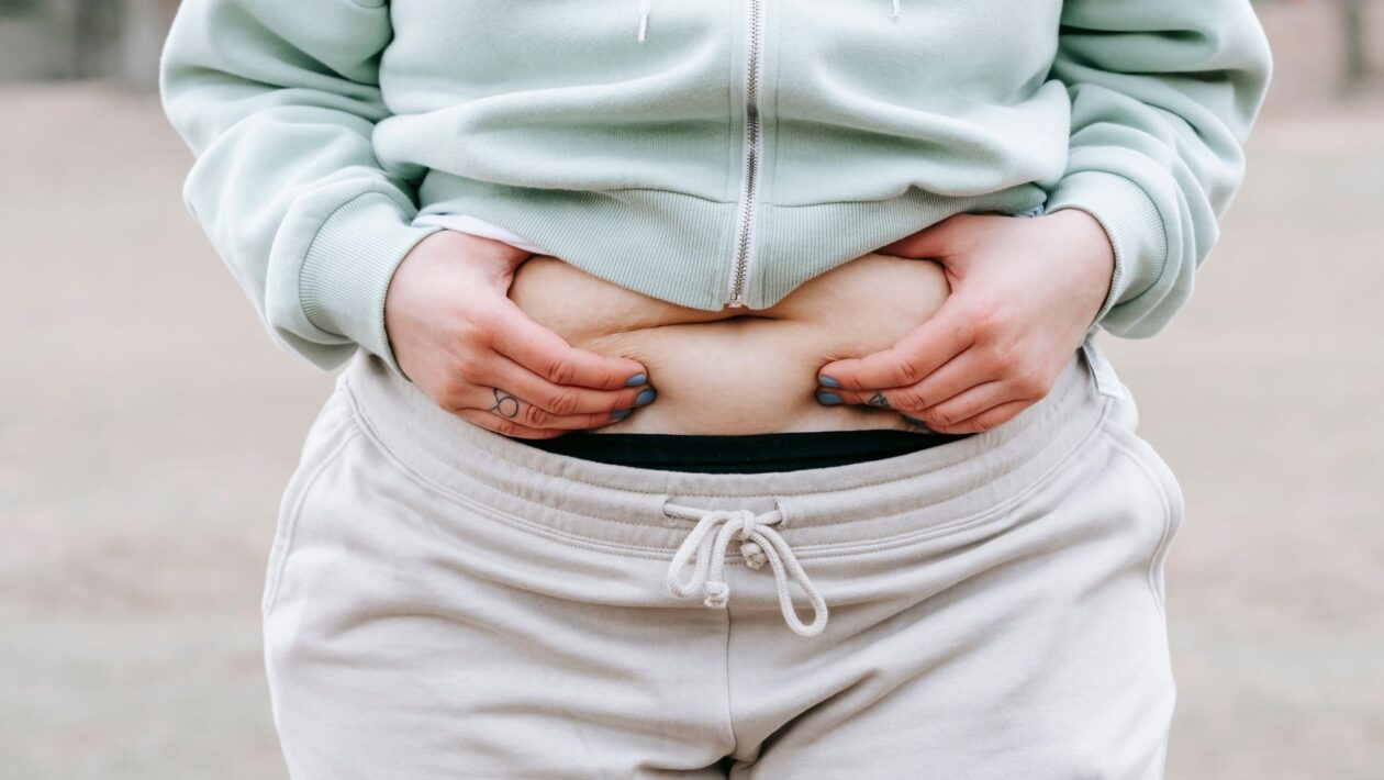Cortisol alto altera onde a gordura se acumula. (Foto: Pexels via Canva)