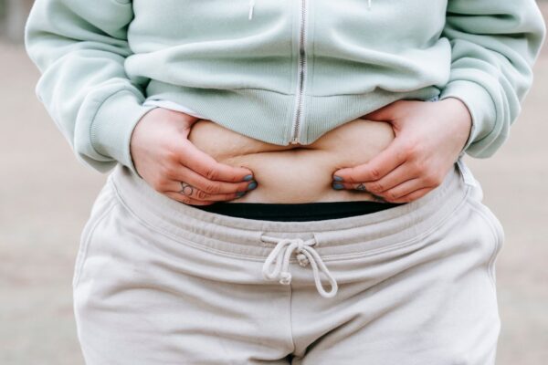Cortisol alto altera onde a gordura se acumula. (Foto: Pexels via Canva)