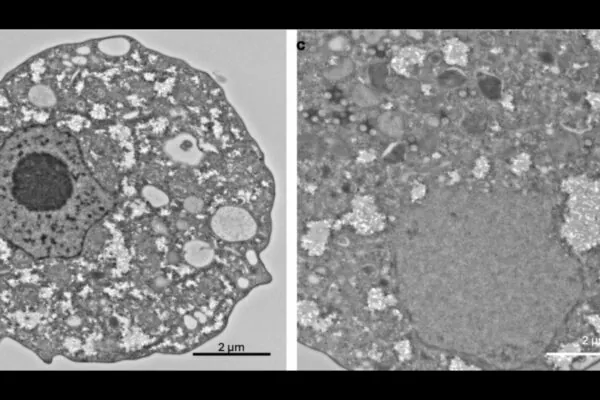 Célula infectada exibe núcleo preservado e ausência de vírions. (Foto: Masaharu Takemura et al. via Journal of Virology)