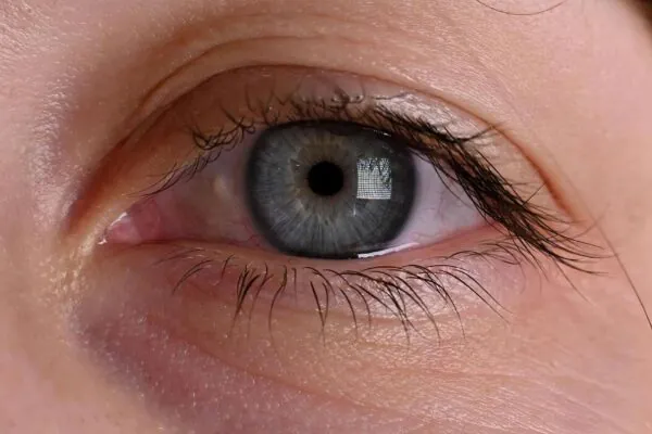 Mioquimia pode surgir por fadiga ocular. (Foto: Geanina Vlasceanu's Images via Canva)