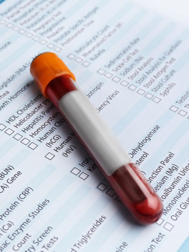 Como ler seus exames de sangue (De forma simples)
